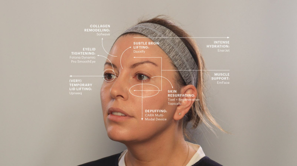 a graphic illustrating eight treatments a woman had done to fake a blepharoplasty treatment